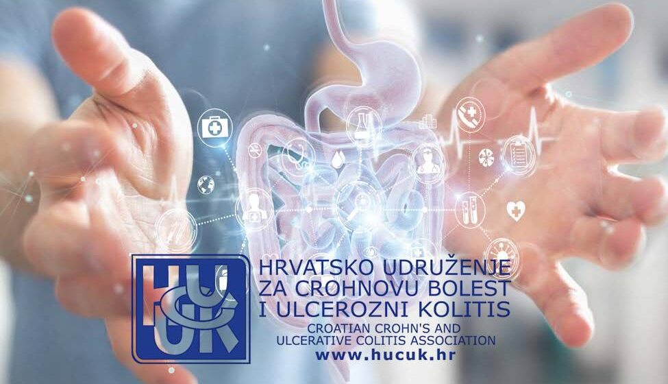Brošura: LIJEČENJE ULCEROZNOG KOLITISA I CROHNOVE BOLESTI